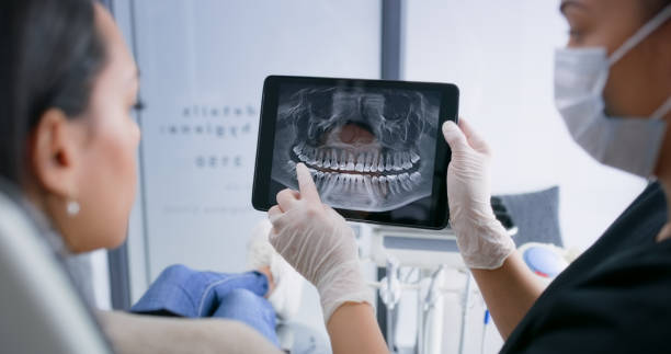 Licensed Wisdom Tooth Removal service in Spearfish, SD - Smile Center Dentistry